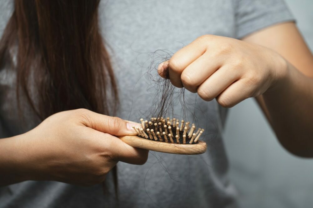 chute de cheveux