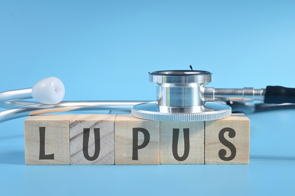 lupus