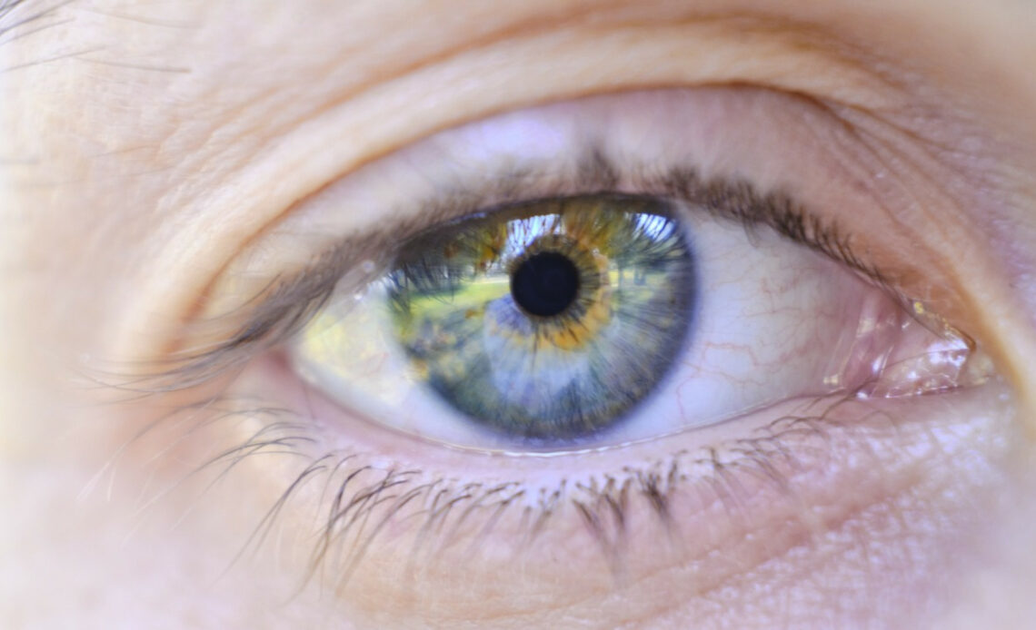 Technique d'opération des yeux au Lasik : une solution efficace pour la myopie et la presbytie