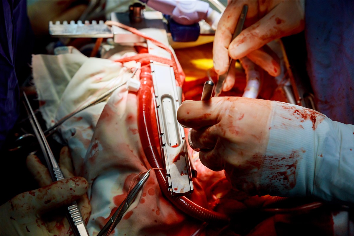 technologie en matière de valves médicales